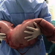 El megacolon de Hai. Imagen: AsiaWire